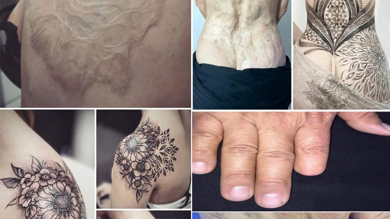 Times People Asked Tattoo Artists To Cover Up Their Scars And Birthmark
